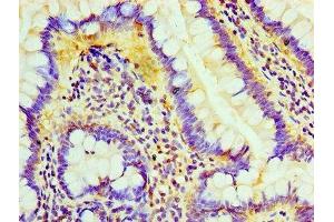 Immunohistochemistry of paraffin-embedded human small intestine tissue using ABIN7158764 at dilution of 1:100 (Lipase A Antikörper  (AA 22-399))