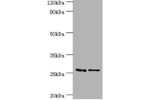 Western blot All lanes: GSTM4 antibody at 10 μg/mL Lane 1: Rat lung tissue Lane 2: MCF-7 whole cell lysate Secondary Goat polyclonal to rabbit IgG at 1/10000 dilution Predicted band size: 26, 23, 19 kDa Observed band size: 26 kDa (GSTM4 Antikörper  (AA 1-218))