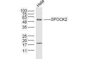 Human Hela cells probed with SPOCK2/Testican 2 Polyclonal Antibody, unconjugated  at 1:300 overnight at 4°C followed by a conjugated secondary antibody at 1:10000 for 90 minutes at 37°C. (SPOCK2/Testican 2 Antikörper  (AA 61-160))