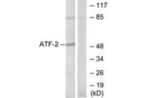 Western blot analysis of extracts from HeLa cells, using ATF2 (Ab-71 or 53) Antibody. (ATF2 Antikörper  (AA 38-87))