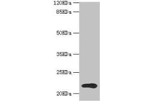 Western blot All lanes: TPD52L1 antibody at 1. (TPD52L1 Antikörper  (AA 1-144))