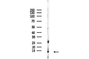 anti-Mitogen-Activated Protein Kinase Kinase 1 Interacting Protein 1 (MAPKSP1) (Internal Region) antibody