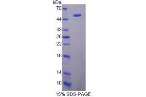 Image no. 1 for HLA-DR-gamma (CD74) (AA 65-277) protein (His tag,GST tag) (ABIN6238494)