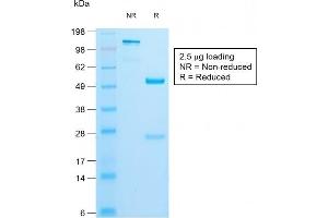 SDS-PAGE Analysis of Purified Insulin Rabbit Recombinant Monoclonal Antibody (IRDN/1980R). (Rekombinanter Insulin Antikörper)