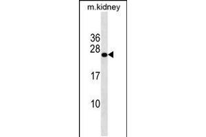 Western blot analysis in mouse kidney tissue lysates (35ug/lane). (GRPEL2 Antikörper  (N-Term))