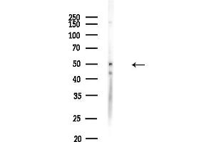 anti-Serine/threonine-Protein Kinase NIM1 (NIM1) (C-Term) antibody