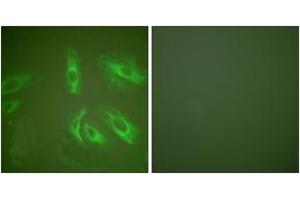Immunofluorescence analysis of HeLa cells, using Gastrin Antibody.