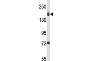 Western blot analysis of Integrin alpha 2 antibody and MDA-MB231 lysate (ITGA2 Antikörper  (AA 1023-1049))