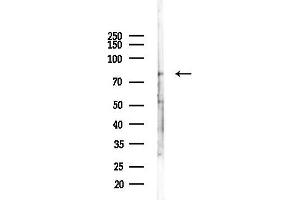 anti-Oxysterol Binding Protein-Like 11 (OSBPL11) antibody