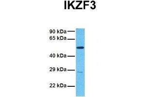 Host:  Rabbit  Target Name:  IKZF3  Sample Tissue:  Human 786-0  Antibody Dilution:  1. (IKZF3 Antikörper  (N-Term))