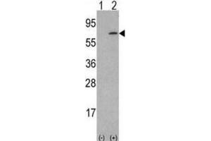 Western Blotting (WB) image for anti-Colony Stimulating Factor 1 (Macrophage) (CSF1) antibody (ABIN3002787)