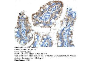 Rabbit Anti-GTPBP9 Antibody  Paraffin Embedded Tissue: Human Intestine Cellular Data: Epithelial cells of intestinal villas Antibody Concentration: 4. (OLA1 Antikörper  (N-Term))
