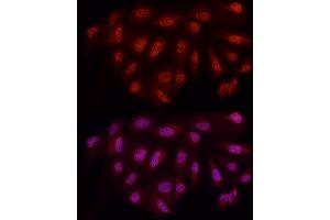 Immunofluorescence analysis of U2OS cells using WTAP Rabbit pAb (ABIN7271372) at dilution of 1:50 (40x lens). (WTAP Antikörper  (AA 1-396))