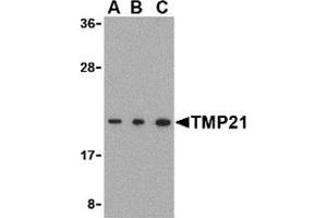 Western blot analysis of TMP21 in Raji cell lysate with this product at (A) 0. (TMED10 Antikörper  (C-Term))