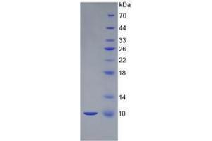 Image no. 1 for S100 Calcium Binding Protein B (S100B) (AA 1-92) (Active) protein (His tag) (ABIN6239830) (S100B Protein (AA 1-92) (His tag))