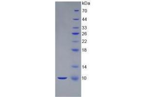Image no. 1 for S100 Calcium Binding Protein B (S100B) (AA 1-92) (Active) protein (His tag) (ABIN6239830)