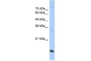 WB Suggested Anti-COX4I1 Antibody Titration:  1. (COX IV Antikörper  (N-Term))