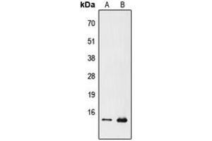 Western blot analysis of PFDN1 expression in Jurkat (A), Raw264. (PFDN1 Antikörper  (N-Term))