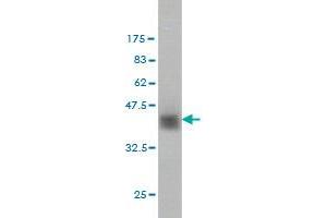 Western Blot detection against Immunogen (37. (ZNF41 Antikörper  (AA 221-321))