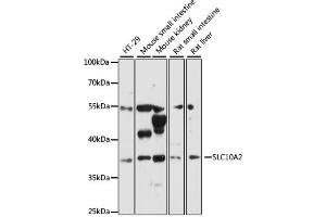 Western blot analysis of extracts of various cell lines, using SLC10A2 antibody (ABIN6292276) at 1:3000 dilution. (SLC10A2 Antikörper)