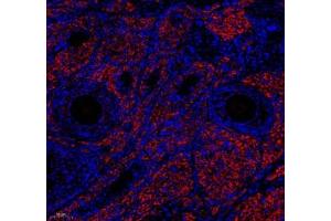 Immunofluorescence of paraffin embedded rat ovary using EMCN (ABIN7073818) at dilution of 1: 600 (180x lens) (Endomucin Antikörper)