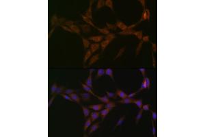 Immunofluorescence analysis of NIH-3T3 cells using 15-PGDH/HPGD Rabbit mAb (ABIN7267807) at dilution of 1:100 (40x lens). (HPGD Antikörper)