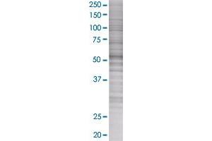CALCOCO2 transfected lysate.