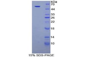 SDS-PAGE (SDS) image for Netrin 1 (NTN1) (AA 313-565) protein (His tag,GST tag) (ABIN2123360)