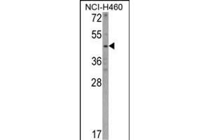 Western blot analysis of KYNU Antibody (C-term) (ABIN390735 and ABIN2841003) in NCI- cell line lysates (35 μg/lane). (KYNU Antikörper  (C-Term))