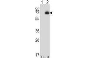 Western Blotting (WB) image for anti-Carboxypeptidase N Subunit 2 (CPN2) antibody (ABIN2997205) (CPN2 Antikörper)