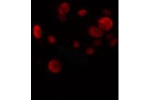 ABIN6274270 staining HuvEc cells by IF/ICC. (ETV1 Antikörper  (N-Term))