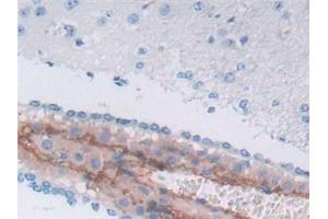 Detection of a1ACT in Mouse Cerebrum Tissue using Polyclonal Antibody to Alpha-1-Antichymotrypsin (a1ACT) (SERPINA3 Antikörper  (AA 23-253))