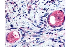 Anti-TMEM5 antibody IHC of human ovary, oocytes. (TMEM5 Antikörper  (Extracellular Domain))