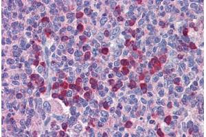 Immunohistochemistry (Formalin-fixed Paraffin-embedded Sections) (IHC (fp)) image for anti-Roundabout, Axon Guidance Receptor, Homolog 2 (ROBO2) (AA 252-301) antibody (ABIN6747098)