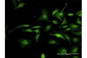 Immunofluorescence of purified MaxPab antibody to CTNND1 on HeLa cell. (CTNND1 Antikörper  (AA 1-610))