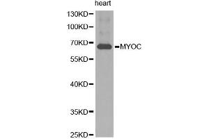 Western Blotting (WB) image for anti-Myocilin (MYOC) (AA 245-504) antibody (ABIN6218662) (MYOC Antikörper  (AA 245-504))