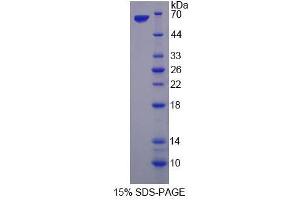 Image no. 1 for serine threonine Kinase 39 (STK39) (AA 63-545) protein (His tag) (ABIN6237655) (STK39 Protein (AA 63-545) (His tag))