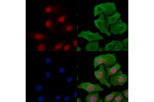 ABIN6257462 and ABIN6274283 staining Hela cells by IF/ICC. (RBM5 Antikörper  (N-Term))