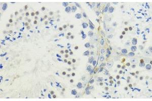 Immunohistochemistry of paraffin-embedded Mouse testis using TriMethyl-Histone H3-K36 Polyclonal Antibody at dilution of 1:200 (40x lens).
