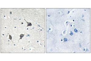 Immunohistochemistry analysis of paraffin-embedded human brain tissue using GPR20 antibody. (GPR20 Antikörper  (C-Term))