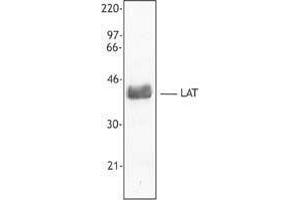 Western Blotting (WB) image for anti-Linker For Activation of T Cells (LAT) antibody (ABIN2666080) (LAT Antikörper)