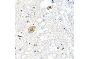 Immunohistochemistry of paraffin-embedded rat brain using FGF13 antibody at dilution of 1:100 (x40 lens). (FGF13 Antikörper)