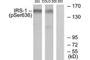 Western Blotting (WB) image for anti-Insulin Receptor Substrate 1 (IRS1) (pSer636) antibody (ABIN2888449) (IRS1 Antikörper  (pSer636))