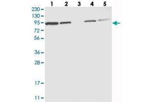 Western blot analysis of Lane 1: RT-4, Lane 2: U-251 MG, Lane 3: Human Plasma, Lane 4: Liver, Lane 5: Tonsil with EFR3A polyclonal antibody  at 1:250-1:500 dilution. (EFR3A Antikörper)