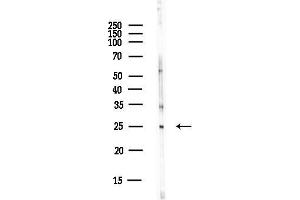anti-General Transcription Factor IIF, Polypeptide 2, 30kDa (GTF2F2) antibody