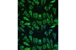 Immunofluorescence analysis of L-929 cells using Galectin 3/Galectin 3/LG antibody (ABIN6130437, ABIN6143158, ABIN6143159 and ABIN7101422) at dilution of 1:100. (Galectin 3 Antikörper  (AA 1-250))