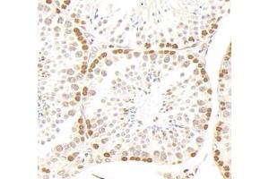 Immunohistochemistry analysis of paraffin-embedded mouse testis using,GSTT1 (ABIN7074091) at dilution of 1: 2000 (GSTT1 Antikörper)