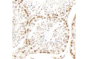 Immunohistochemistry analysis of paraffin-embedded mouse testis using,GSTT1 (ABIN7074091) at dilution of 1: 2000