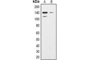 Western blot analysis of SHIP2 expression in K562 (A), Hela (B) whole cell lysates. (INPPL1 Antikörper)