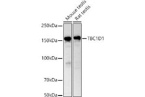 Western blot analysis of extracts of various cell lines, using TBC1D1 antibody (ABIN6129487, ABIN6148878, ABIN6148879 and ABIN6225024) at 1:1000 dilution. (TBC1D1 Antikörper  (AA 520-710))